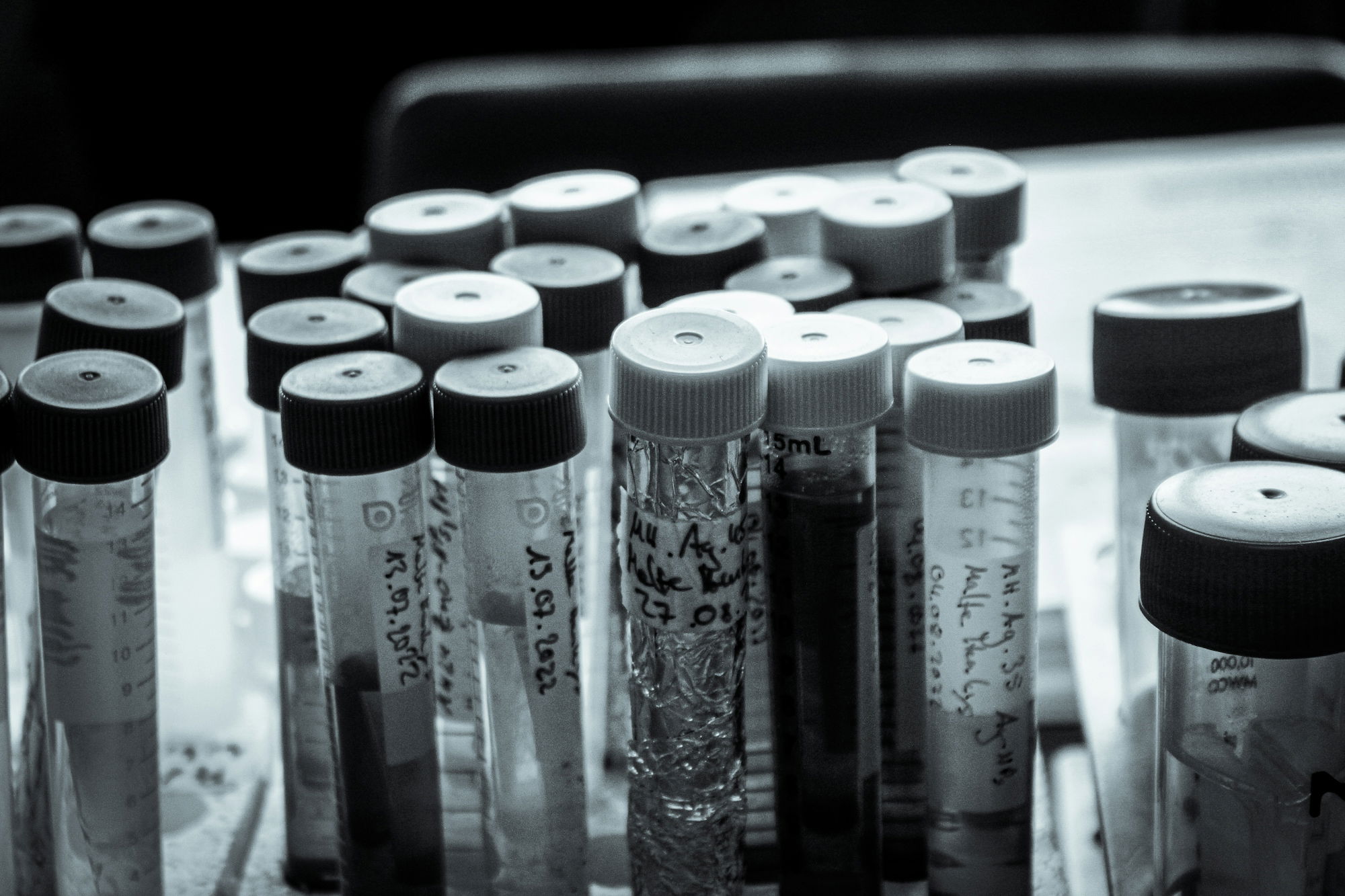 a-bunch-of-pens-sitting-on-top-of-a-table.jpg a bunch of pens sitting on top of a table